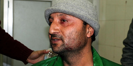 Four Kashmiri photojournalists hit by pellet-gun fire from Indian security forces