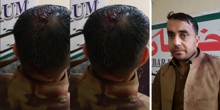 Masked men attack and injure reporter in Peshawar