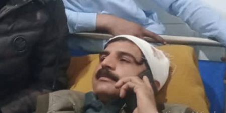 President Haripur Press Club Zakir Tanoli injured in attack