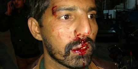 Drunken cops beat up media workers in Sukkur
