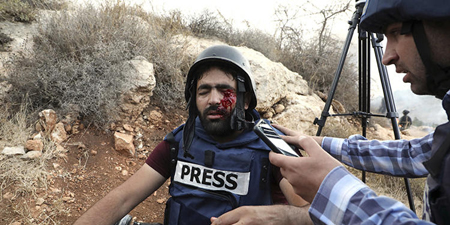 Palestinian photographer injured by Israeli forces