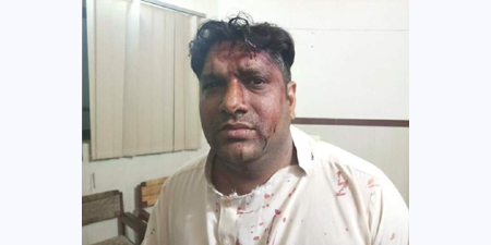 Capital TV reporter injured in alleged attack by PML-N MPA and accomplices